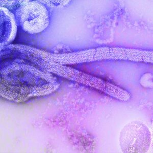Parasite Detoxification